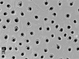 顯微鏡底下的象牙質管道 顯微鏡底下的象牙質管道